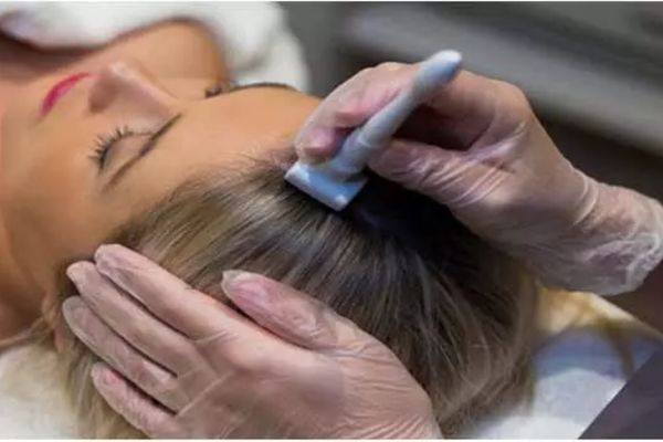 Derma Rollers Treatment