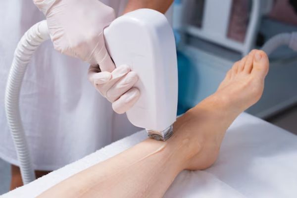 Hand_Leg Hair Reduction