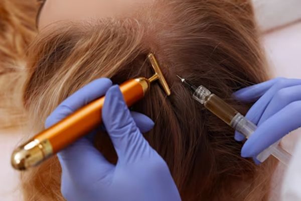 PRP Treatment
