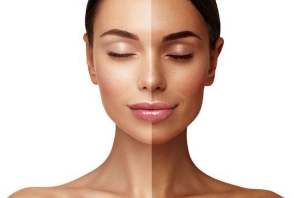 Skin Whitening Treatment