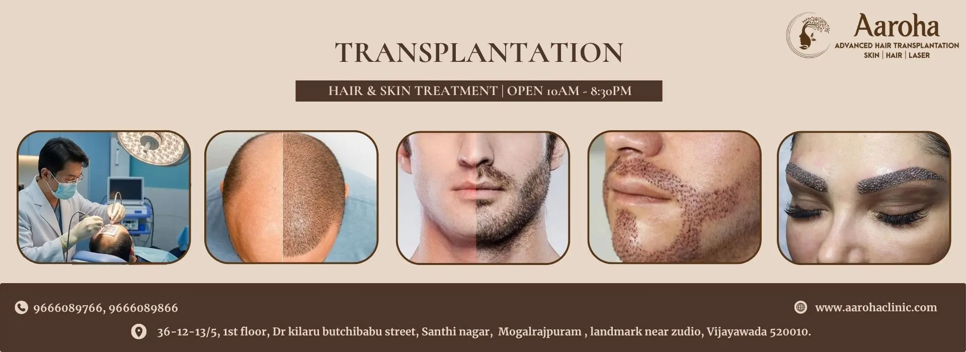 TRANSPLANTATION IMAGE BANNER