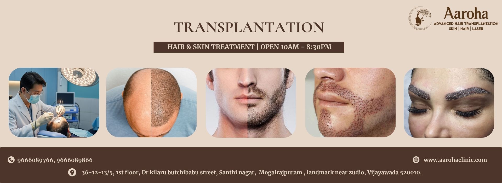 Transplantation banner1