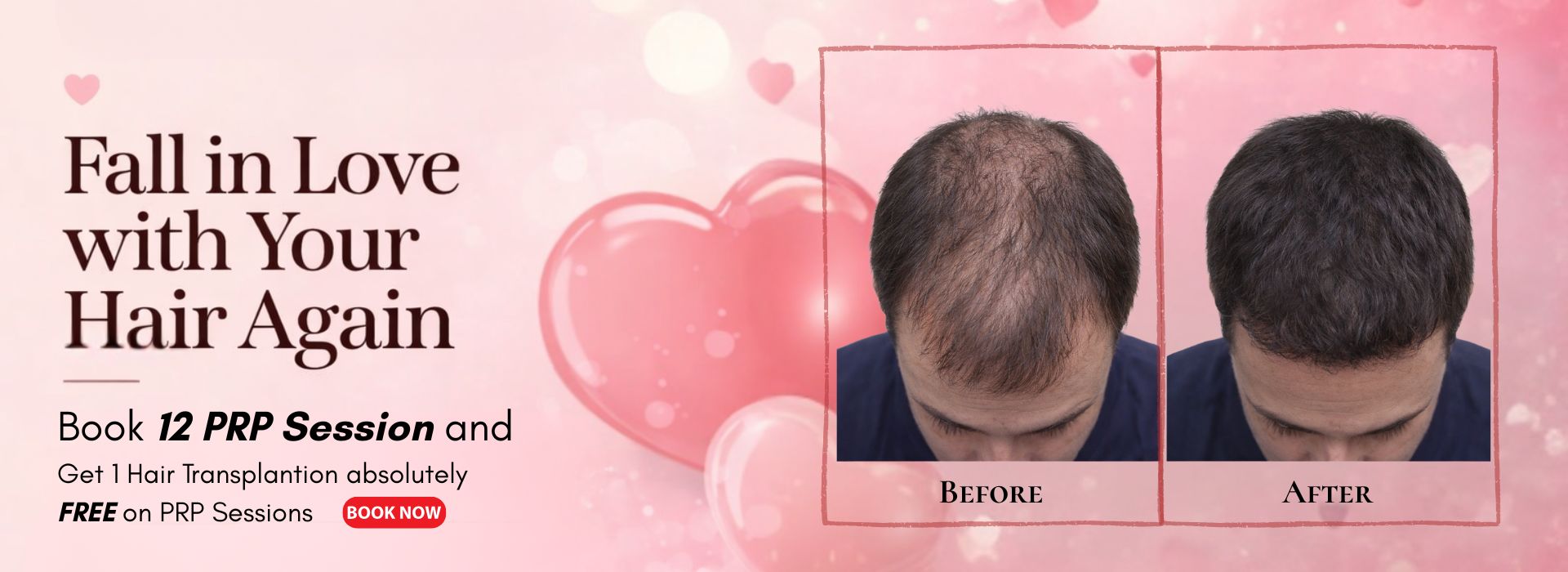 Valentine day banner for PRP